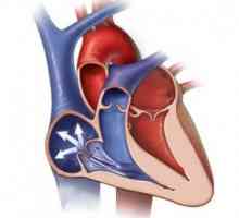 Srce regurgitacije ventil: simptomi, mjeri, dijagnoza, liječenje