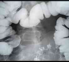 Crijeva rendgenski s barij: Poseban postupak