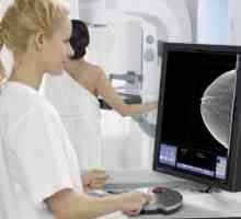 Rendgenski probir dojke: mamografija