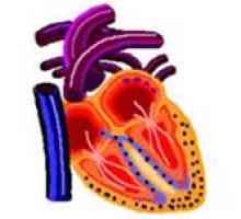 Restriktivnu kardiomiopatiju, naročito njihovo liječenje