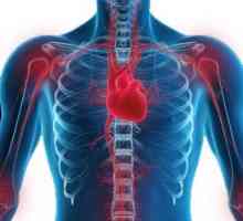 Reumatska groznica i reumatska bolest srca: simptomi, srčane manifestacije, dijagnoze, liječenje,…