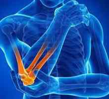 Reumatoidni artritis. Liječenje narodnih lijekova