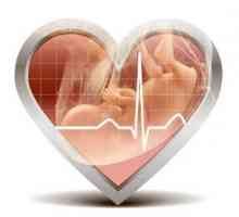 Otkucaji srca fetusa kada je i kako je moguće čuti i kršenja pravilo