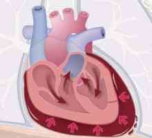 Tamponada srca: simptomi, dijagnoza, prva pomoć, liječenje