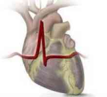 Reumatske srce