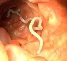 Simptomatologija i liječenje crva