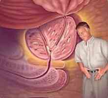 Simptomi benigne hiperplazije prostate