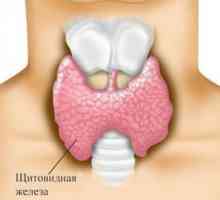Simptomi autoimuni tiroiditis ili limfomatozne