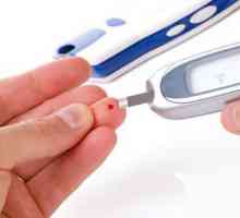 Simptomi i liječenje dijabetesa tipa 2