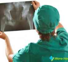 Simptomi i liječenje ozljeda trtica