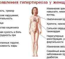 Simptomi i znakovi hipertireoze kod žena