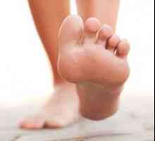 Dijabetes sindrom stopala: indikacije, izgleda razvoju nego liječiti