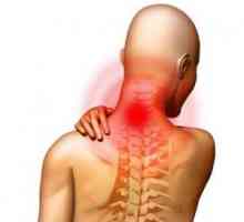 Sindrom vertebralne arterije: definicija, simptomi, liječenje, rizične skupine