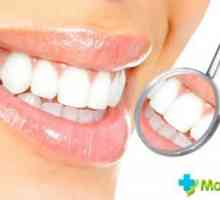 Koliko je za izbjeljivanje zubi kod zubara: vrste i troškovi izbjeljivanje