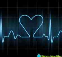 Slabo srce - prilika za posjet kardiologa