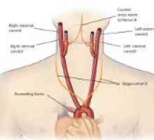 Karotidnih arterija i njegova