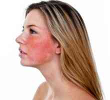 Vaskularna oštećenja na licu: zašto i kako se nositi s njima?