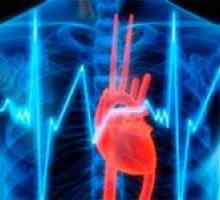 Stabilna angina: njegovih funkcionalnih klasa i liječenje
