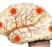 Koji alati su najprikladniji za jačanje krvnih žila u mozgu?