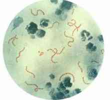 Streptococcus. Streptococcus otkrivena u nos, grlo, ždrijelo, kože, što da radim? Streptococcus u…