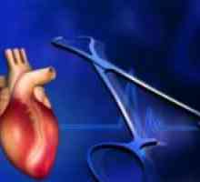 Kako liječiti bolest srca