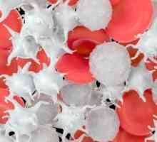 Trombocitoza: izgled i oblik, simptomi, liječenje i prevenciju komplikacija