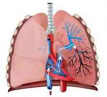 Plućna embolija (PE): uzroci, simptomi, liječenje