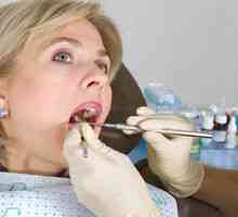Uklanjanje zubnog kamen sa ultrazvuka