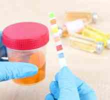 Analiza mikroalbuminurija: pravila za prikupljanje i dekodiranje urina