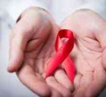 HIV infekcija: simptomi kod muškaraca, liječenje