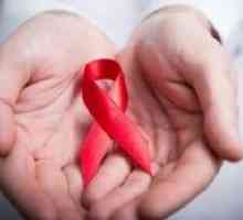 HIV infekcija: simptomi kod žena i prognoza nakon tretmana