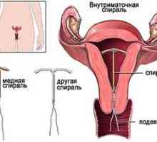 Utjecaj mornarice na menstruacije u žena od 18