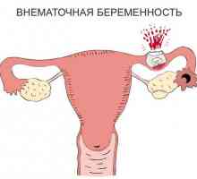 Izvanmaternične trudnoće u ranim fazama: znakovi i simptomi