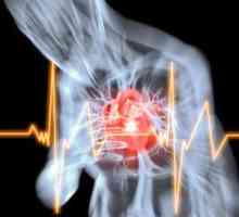 Iznenadna smrt od akutne srčane uzrokuje koronarne insuficijencije i drugih