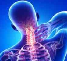 Moguće posljedice pravom hipoplazije vertebralne arterije