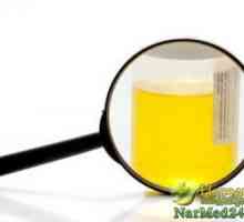 Pojava bjelančevina u urinu i njegove eliminacije metode tradicionalne medicine