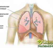 Pojava upala pluća pluća i njegove obrade narodnih lijekova