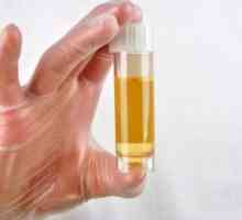 Sekundarna urina - što je to, dijagnoza i analiza