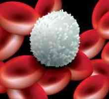 Što bijelih krvnih stanica, a što je uzrokovalo promjenu u njihove razine u krvi?