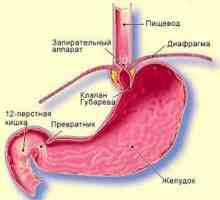 Bolesti žuči refluks gastritis