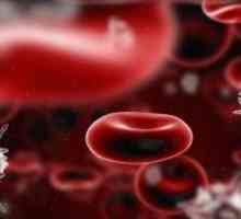 Poremećaji krvi: popis najčešćih i ozbiljnih bolesti