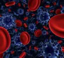 Poremećaji krvi u odraslih: Simptomi koji se javljaju ovisno o bolesti