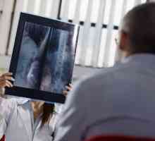 Zašto je rendgenski želuca s barij?