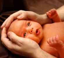 Žutica u novorođenčadi - Simptomi i liječenje