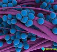 Staphylococcus aureus u djece - da li je opasno, a kad je potrebno alarm?