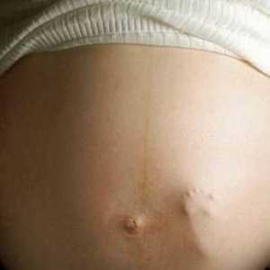 34 Tjedana trudnoće