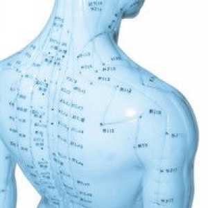 Akupunktura - aktivna pomoć pri osteochondrosis