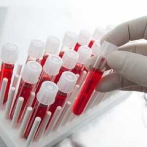 Alt analiza krvi: to je norma i odstupanje od norme