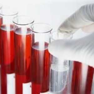 Krvni testovi, istraživanje o hormonima i dekodiranje