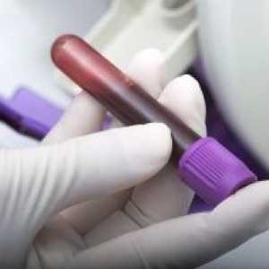 Test krvi za anti nvcor: postavljanje i dekodiranje